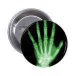 Green X-ray Skeleton Hand Pinback Button