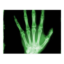 Green X-ray Skeleton Hand Postcards