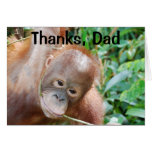Hairline and Baldness Humour For Father From Son Greeting Card