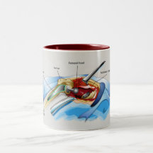 Hip Replacement Infographic Mug (version 1)