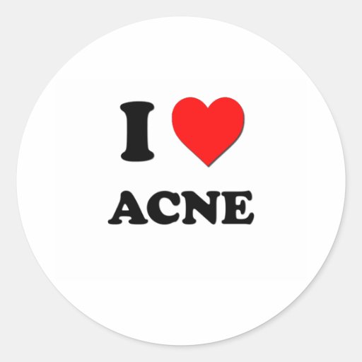 I Love Acne Round Stickers