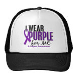 I Wear Purple For ME 10 Lupus Hat