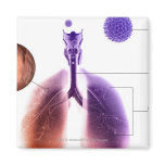 Illustration of an asthma attack from pollen magnets