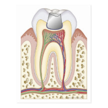 Illustration of Dental Filling Post Card
