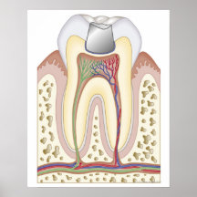 Illustration of Dental Filling Print