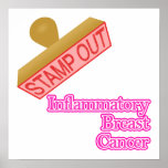 Inflammatory Breast Cancer Print