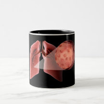 Inflammed airway during an asthma attack mugs