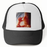 It's a Child.......Not a Choice!! hats