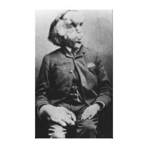 Joseph "John" Merrick The Elephant Man from 1889 Canvas Print