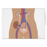Kidney Transplant Greeting Card