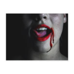 Love Bite postcards