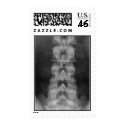 lumbar_spine_01 postage
