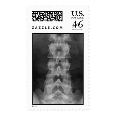 Lumbar Spine X-ray Postage by jeffsdx