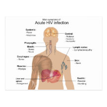 Main Symptoms of Acute HIV Infection Post Cards