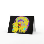 Mark's colourized MRI cards
