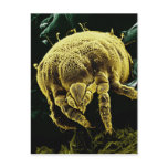 Microscopic Arthropod Acari Mite Lorryia Formosa postcards