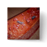 Microscopic rendering of a blood infection pins