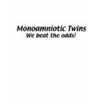 Monoamniotic Twins t-shirts