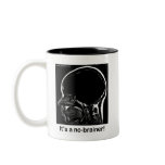 MRI: It's a no-brainer! mugs