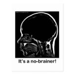 MRI: It's a no-brainer! Post Cards