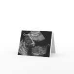 New Baby Ultrasound cards