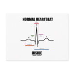 Normal Heartbeat Inside (ECG EKG) Post Cards