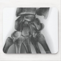 Normal wrist, X-ray Mouse Pads