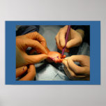 Paediatrics Hand Surgery posters