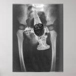 Pelvic X-ray Gnome poster posters