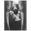 Pelvic X-ray Gnome t-shirt