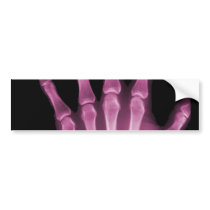Pink X-ray Skeleton Hand