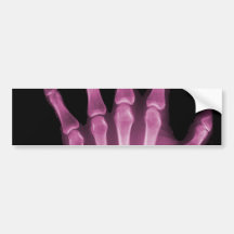 Pink X-ray Skeleton Hand Bumper Sticker