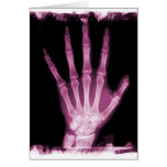 Pink X-ray Skeleton Hand cards