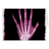 Pink X-ray Skeleton Hand