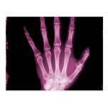 Pink X-ray Skeleton Hand Post Card