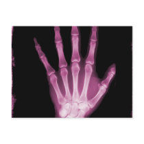 Pink X-ray Skeleton Hand