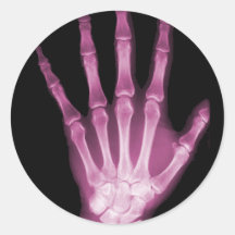 Pink X-ray Skeleton Hand Round Sticker