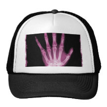 Pink X-ray Skeleton Hand Trucker Hats