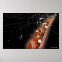 Plaque in the arteries posters
