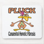 Pluck Congenital Hepatic Fibrosis Mousepad