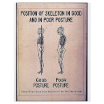 Position Of Skeleton In Good And In Poor Posture flyers