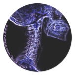 Purple/Blue C-spine sticker