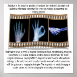 RADIOLOGY - XRAY POSTER - HAND, OK, HANDSHAKE posters