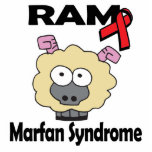 RAM Marfan Syndrome Photo Sculptures