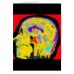 sagital MRI cards