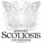 Scoliosis Butterfly photo sculptures