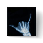 Shaka Sign X-Ray (Hang Loose) buttons