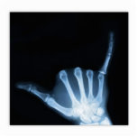 Shaka Sign X-Ray (Hang Loose) photo sculptures