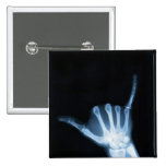 Shaka Sign X-Ray (Hang Loose) Pins