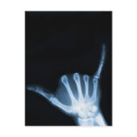 Shaka Sign X-Ray (Hang Loose) Post Cards